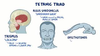 Clostridium tetani tetanus causes symptoms diagnosis treatment pathology [upl. by Reddin]