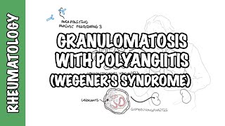 Granulomatosis with Polyangiitis pathophysiology symptoms treatment [upl. by Genovera]