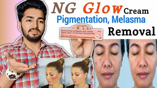 NG Glow Cream Review  NG Glow Cream For Melasma and Pigmentation [upl. by Acimaj]