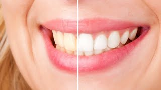 Best Whitening Toothpaste 2022  Top 5 Whitening Toothpastes [upl. by Brighton]