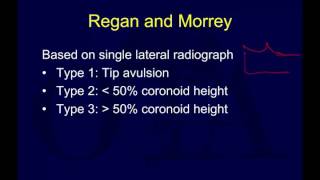 Traumatic elbow instability  terrible triad OTA lecture series IV u06b [upl. by Etnomed]