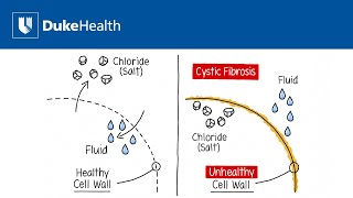 What is Cystic Fibrosis  Duke Health [upl. by Sachi]