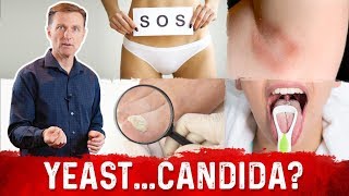 Yeast Infection vs Candida Infection Is there a Difference – DrBerg [upl. by Mattheus207]