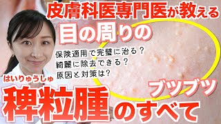 【実は簡単！】皮膚科専門医が教える目の周りのブツブツ「稗粒腫」の治し方と予防法 [upl. by Nuahc]