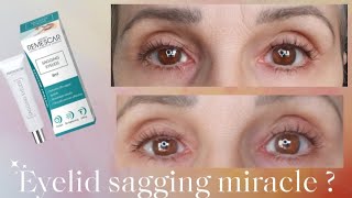 Sagging Eyelids is this gel a miracle [upl. by Ytsur212]