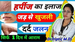 हर्पीज क्या है होम्योपैथिक इलाज  Homeopathic Treatment of Harpes in Hindi DrTripti [upl. by Cusack]