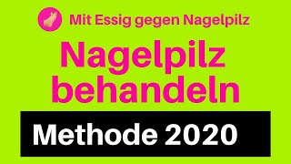 Nagelpilz Behandlung Essig gegen Nagelpilz 2020 entfernen loswerden [upl. by Newra]