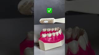 Correct way of Brushing technique dentalcare dentalhygiene dentalhygienelife dentalclinic clean [upl. by Luwana]