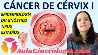 ¿Cómo funciona la quimioterapia y cómo afecta al cuerpo  ExclusivoMSP [upl. by Efar628]