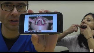 Taking intraoral photographs at home [upl. by Ahsienad]