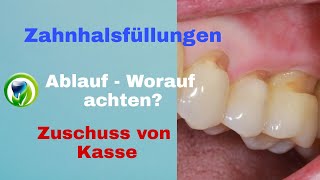 Ablauf von Zahnhalsfüllungen  Vorgehen Welche Kleinigkeiten beachten Abrechnung Klasse V Füllung [upl. by Hiroko]