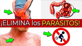 Consecuencias en tu cuerpo de tener parásitos y qué es bueno para eliminarlos [upl. by Hickey203]