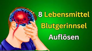 Die 8 besten Lebensmittel zur natürlichen Auflösung von Blutgerinnseln Gesunde Ernährungstipps [upl. by Angelica]