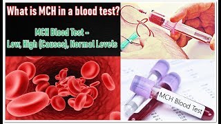 MCH Blood Test – Low High Causes Normal Levels [upl. by Eixel]