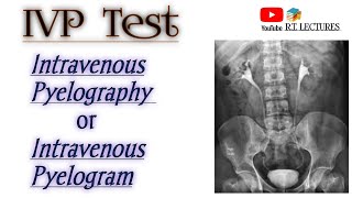 IVP testIntravenous Pyelography IVUIntravenous Urographytest Excretoru Urography test complte [upl. by Naik364]