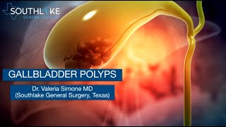 Gallbladder Polyps – Causes Symptoms amp Treatment [upl. by Stout]