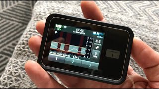 Living with a Hybrid Closed Loop Insulin Pump Artificial Pancreas The Basics [upl. by Nnarefinnej50]