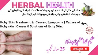 Itchy Skin Treatment amp Causes Symptoms  Causes of Itchy skin  Causes amp Solutions of Itchy Skin [upl. by Rafter]