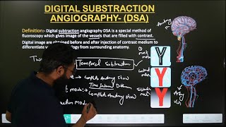 DSA  DIGITAL SUBTRACTION ANGIOGRAPHY  PRINCIPLE PART1 TYPE OF DSA  IN HINDI  MADE EASY [upl. by Naitsihc405]