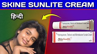 Skine Sunlite Cream Review in Hindi  by Mt discuss [upl. by Kiele]