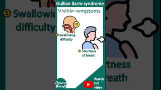 Guillain–Barré syndrome  Acute inflammatory demyelinating polyneuropathy AIDP  Pathology USMLE [upl. by Nosmoht]