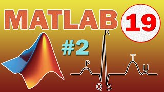 Matlab 19 Synthèse dun signal ECG Périodique  Peigne de Dirac TUTO [upl. by Alphonso]