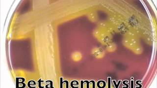 Comparison of hemolysis on blood agarmov [upl. by Eiduj]