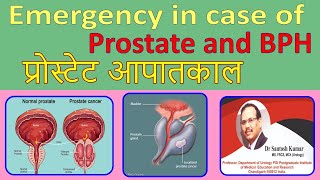 Emergency in case of Prostate and BPH DrProfSantosh Kumar PGI [upl. by Carothers]