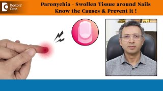 SWOLLEN TISSUE around NailsPARONYCHIACauses Prevention amp TreatmentDrNischal K CDoctors Circle [upl. by Harrington]