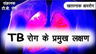 टी बी रोग  क्षयरोग रोग के लक्षण  Symptoms of TB disease  Tb rog ke lakshan in hindi [upl. by Ardra273]