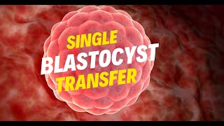 The Power of Single Blastocyst Transfer  IVF Treatment Ivftreatment ivf ivfjourney [upl. by Spohr]