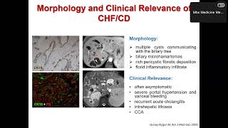Presentazione lavoro di ricerca  Dal fegato policistico al colangiocarcinoma [upl. by Eerbua]