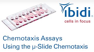 Chemotaxis Assays Using the ibidi µSlide Chemotaxis [upl. by Kowal477]