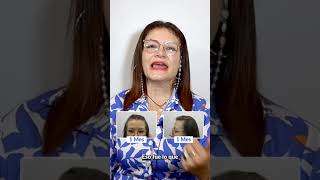 Trasplante Capilar en Mujeres 😱 Recupera tu cabello con los mejores Agenda tu valoración gratuita ✨ [upl. by Cornew]