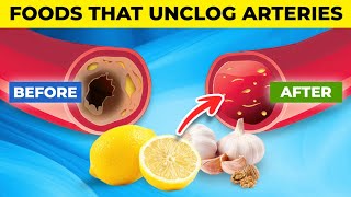 10 AMAZING Foods that UNCLOG Arteries [upl. by Anna]