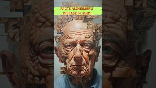 Facts about Alzheimers  Bhulne ki Bimari shorts [upl. by Ettezzus]