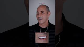 dentist hollywoodsmileturkey dentalcare smilemakeoverturkey dentalprocedure beforeandafter [upl. by Tigdirb]