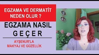 Egzama Ve Dermatit Niye OlurNasıl Geçer [upl. by Gathers407]