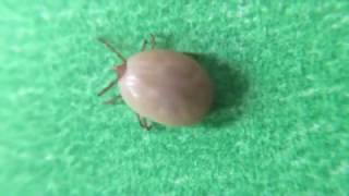 Tick Flicks  Deer Tick [upl. by Daveen753]