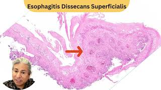 Theres nothing more satisfying in the esophagus than this diagnosis 🥳📚🔬 [upl. by Anivol]