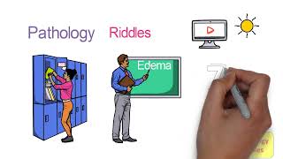 Edema Pathophysiology Part  1 Definition Physiology of Microcirculation  How Does Edema Occur [upl. by Odlanyer]