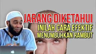 JARANG DIKETAHUI Inilah Cara Efektif Menumbuhkan Rambut Yang Botak  dr Zaidul Akbar [upl. by Refinne]