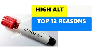 HIGH ALT LEVELS  TOP 12 REASONS [upl. by Aro]