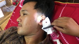 Asmr earideas waxing cleaning cleaning wax ear asmrsounds asmr love [upl. by Courtund]