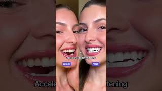 Glow up your smile withTriple LED power 4 brushing moi [upl. by Nareht]