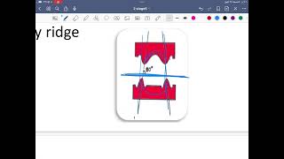 Classification systems for completely edentulous prosthodontic lec2stage5 [upl. by Asel]