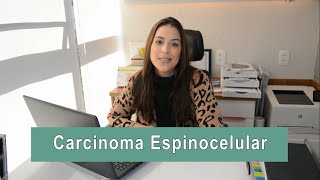 PÍLULA DERMATOSCÓPICA 5 CARCINOMA ESPINOCELULAR [upl. by Tur]