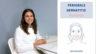 Periorale Dermatitis  Entzündlicher Hautausschlag um den Mund│Dr med Alice Martin [upl. by Barby805]