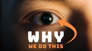 Why Optometrists Dilate Your Eyes [upl. by Adlev992]