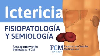 Ictericia  Fisiopatología y Semiología [upl. by Ramirolg157]